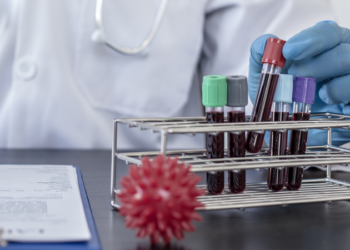 Marburg Virus Outbreak in Rwanda Claims 11 Lives – What You Need to Know